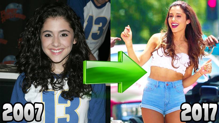 Ariana Grande S Before And After Photos Prove That She Had Plastic